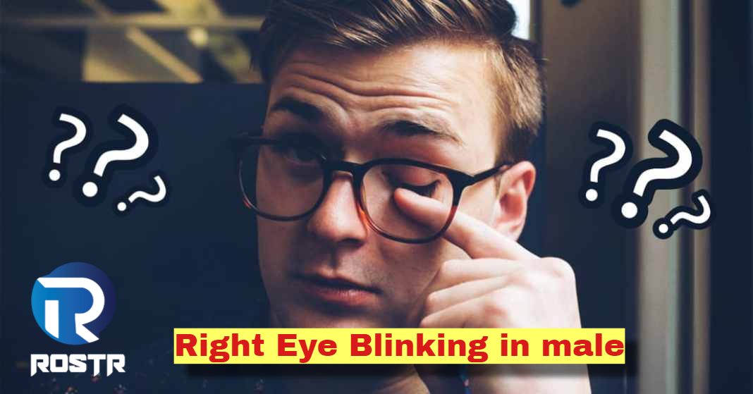 Right Eye Blinking in male